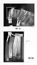 Fig. 09 - Metal joining and strengthening methods utilizing microstructural enhancement