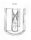 Fig. 04 - Pulse activated actuator pump system