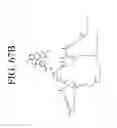 Fig. 79 - KDR and VEGF/KDR binding peptides and their use in diagnosis and therapy