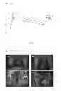 Fig. 06 - Hydrophilic nanoparticles surface-modified with monosaccharide phosphate or monosaccharide phosphate derivatives, its colloidal solution and use thereof