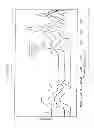 Fig. 02 - Detection and removal of carious dentin tissue