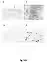 Fig. 06 - Selective elimination of erosive cells