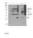 Fig. 12 - DIAGNOSTIC AND THERAPEUTIC TARGET