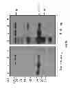 Fig. 13 - DIAGNOSTIC AND THERAPEUTIC TARGET