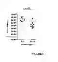 Fig. 06 - STAPHYLOCOCCUS AUREUS DIV1B FOR USE AS VACCINE