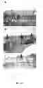 Fig. 06 - Carious tooth vaccine and preparation method