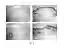 Fig. 06 - Dermal micro-organs, methods and apparatuses for producing and using the same