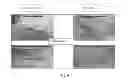 Fig. 09 - Dermal micro-organs, methods and apparatuses for producing and using the same