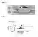 Fig. 02 - Methods and compositions for the treatment of open and closed wound spinal cord injuries