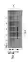 Fig. 02 - Antibodies to phosphorylated tau aggregates