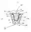 Fig. 01 - Beverage cartridge