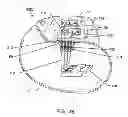 Fig. 22 - Co-fired hermetically sealed feedthrough with alumina substrate and platinum filled via for an active implantable medical device