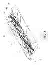 Fig. 06 - OFF-SET GEARS AND METHODS OF USING OFF-SET GEARS FOR PRODUCING CUSHIONING MATERIAL