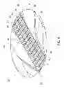 Fig. 07 - OFF-SET GEARS AND METHODS OF USING OFF-SET GEARS FOR PRODUCING CUSHIONING MATERIAL