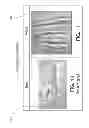 Fig. 11 - OFF-SET GEARS AND METHODS OF USING OFF-SET GEARS FOR PRODUCING CUSHIONING MATERIAL