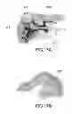 Fig. 16 - MOLDED ARTICLE PRODUCING METHOD AND MOLDED ARTICLE
