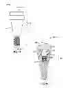 Fig. 08 - Fixed hybrid dental attachment device and methods of using same