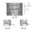 Fig. 12 - Fabrication of maxillofacial surgical splints