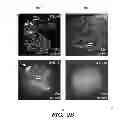 Fig. 07 - METHOD FOR PREDICTING RESPONSIVENESS TO DRUGS