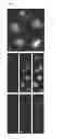 Fig. 05 - Methods and system for the automated determination of immunofluorescent foci using a cell-based immunofluorescence assay using synthetic calibration particles
