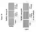 Fig. 52 - Methods for determining drug efficacy using cereblon-associated proteins