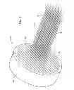 Fig. 07 - Needle array assembly and method for delivering therapeutic agents