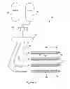 Fig. 08 - Needle array assembly and method for delivering therapeutic agents