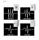 Fig. 06 - COMPOSITIONS AND METHODS TO ASSESS THE CAPACITY OF HDL TO SUPPORT REVERSE CHOLESTEROL TRANSPORT