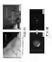 Fig. 17 - Silicon substrates with doped surface contacts formed from doped silicon based inks and corresponding processes