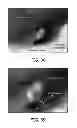 Fig. 19 - Silicon substrates with doped surface contacts formed from doped silicon based inks and corresponding processes