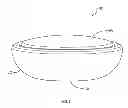 Fig. 02 - Core strengthening device