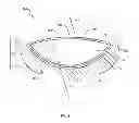 Fig. 04 - Core strengthening device