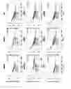 Fig. 20 - Composition or kit for making a prognosis of liver cancer, and method for making a prognosis of liver cancer