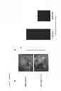 Fig. 07 - METHOD FOR INHIBITING PERITONEAL METASTASIS CAUSED BY GASTRIC CANCER CELLS