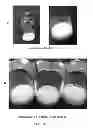 Fig. 08 - LYOPHILIZED FORMULATION OF TAT-NR2B9C