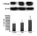 Fig. 04 - METHOD FOR SCREENING OF AGENT FOR TREATING OR PREVENTING OBESITY