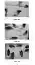 Fig. 12 - Small molecule xanthine oxidase inhibitors and methods of use