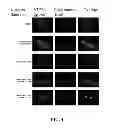 Fig. 05 - Small Molecule Inhibitors of P-type ATPases