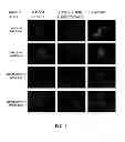 Fig. 07 - Small Molecule Inhibitors of P-type ATPases