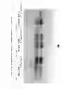 Fig. 08 - Small Molecule Inhibitors of P-type ATPases