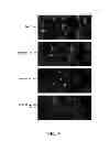 Fig. 09 - Small Molecule Inhibitors of P-type ATPases