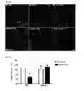 Fig. 09 - METHODS USEFUL IN THE PREVENTION OF HYPOXIC INJURY