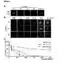 Fig. 07 - Beta-lactones as antibacterial agents