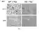 Fig. 04 - USES OF AND METHODS OF TREATMENT WITH CYSTATHIONINE