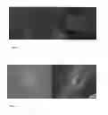 Fig. 05 - Thermo-reversible phase selective xerogel compositions