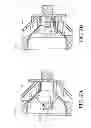 Fig. 04 - Patient alignment system with external measurement and object coordination for radiation therapy system