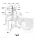 Fig. 08 - IMPLANTABLE ACTUATOR FOR HEARING AID APPLICATION