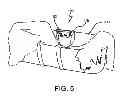 Fig. 07 - Vibrating Baby Attachment