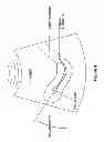 Fig. 04 - Sonography Guided Embryo Transfer For In Vitro Fertilization