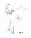 Fig. 09 - Method and system for transhiatal esophagectomy